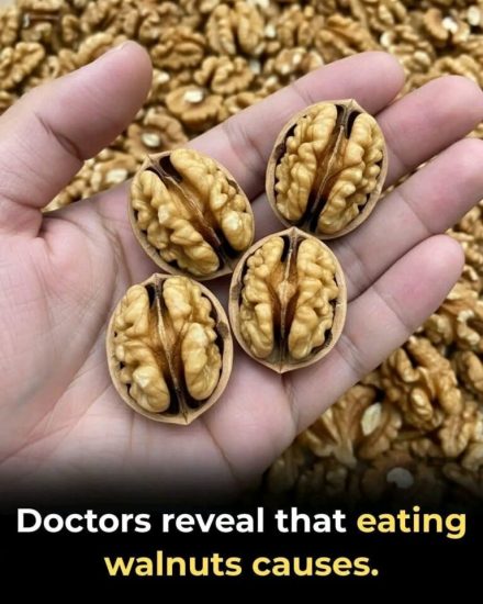 The Health Benefits of Walnuts: A Superfood for Heart, Brain, and Overall Well-being