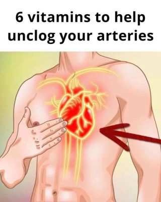 6 Vitamins to Unclog Your Arteries
