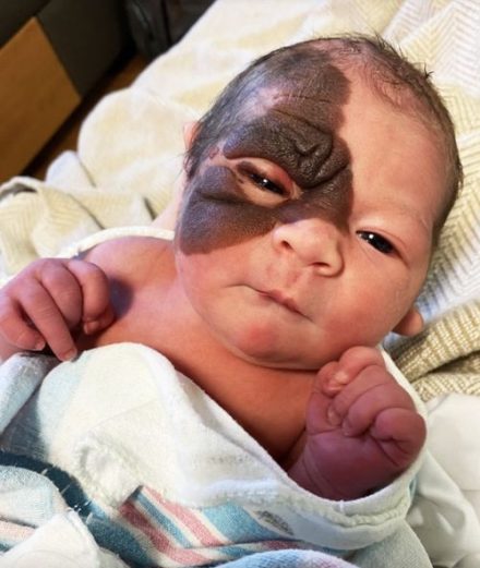Parents stunned when they seen newborn daughter for the first tim